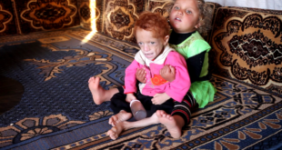 نقص التغذية ينتشر بين أطفال إدلب - محمد بلعاس